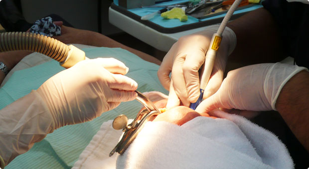 患者さんに合わせた強度、弾性で製作します。