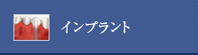 インプラント